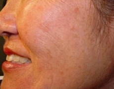 skin_rj2